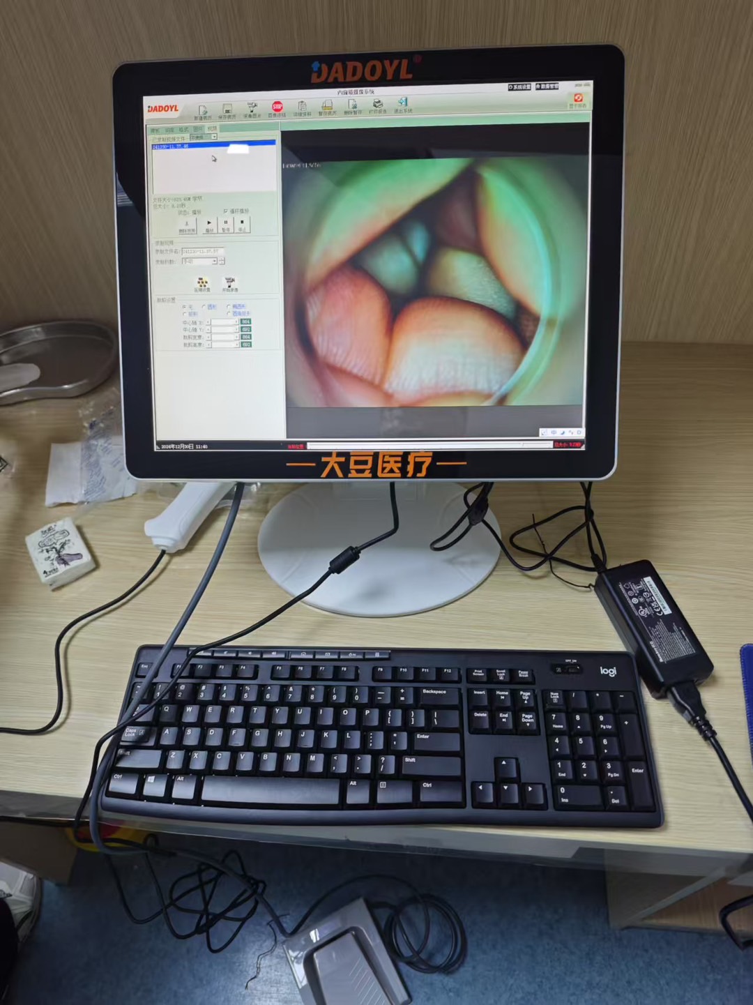 【大豆醫療】云南省某醫院便攜式電子肛門鏡DD-100型裝機培訓